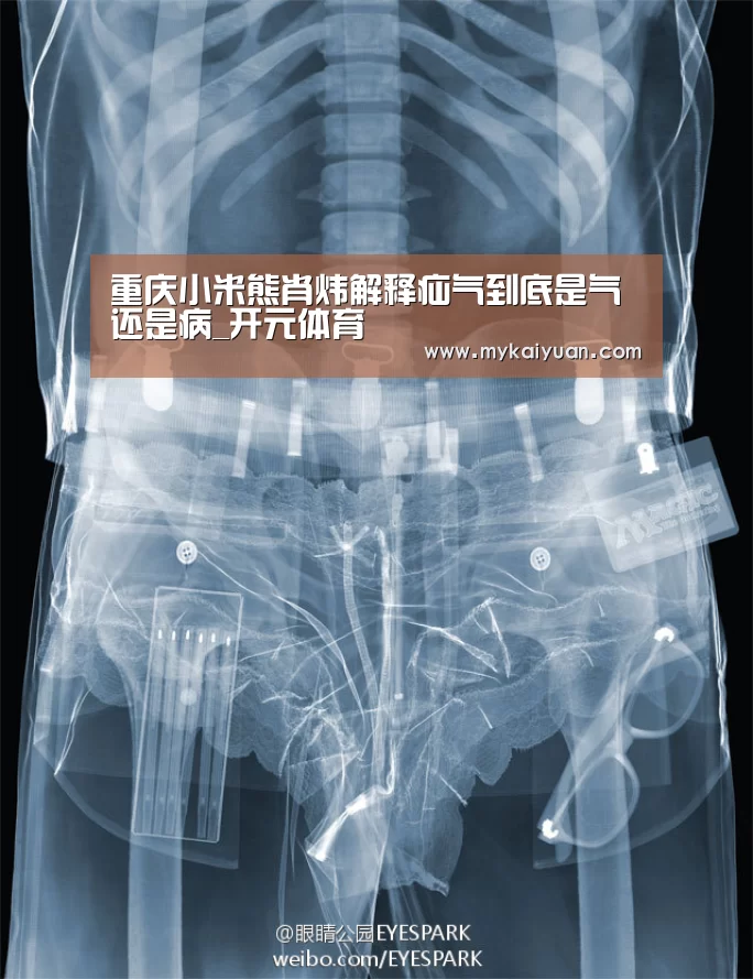 重庆小米熊肖炜解释疝气到底是气还是病_开元体育(图2) 开元APP